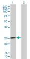 TATA-Box Binding Protein Associated Factor 10 antibody, H00006881-D01P, Novus Biologicals, Western Blot image 