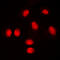 RUNX Family Transcription Factor 1 antibody, LS-C353932, Lifespan Biosciences, Immunofluorescence image 