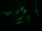 Gamma-Butyrobetaine Hydroxylase 1 antibody, LS-C787841, Lifespan Biosciences, Immunofluorescence image 