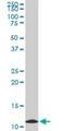 Mitochondrial import inner membrane translocase subunit Tim9 antibody, H00026520-M01, Novus Biologicals, Western Blot image 