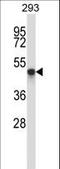 TOM1-like protein 1 antibody, LS-C160107, Lifespan Biosciences, Western Blot image 