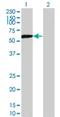 Dihydropyrimidinase Like 5 antibody, H00056896-M02, Novus Biologicals, Western Blot image 