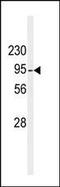 Diacylglycerol Kinase Beta antibody, PA5-15416, Invitrogen Antibodies, Western Blot image 