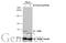 Eukaryotic Translation Initiation Factor 2 Alpha Kinase 2 antibody, GTX130941, GeneTex, Western Blot image 