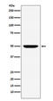 Interferon Regulatory Factor 4 antibody, M00401, Boster Biological Technology, Western Blot image 