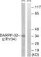 Protein Phosphatase 1 Regulatory Inhibitor Subunit 1B antibody, PA5-39693, Invitrogen Antibodies, Western Blot image 