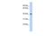 Insulin Induced Gene 1 antibody, GTX47436, GeneTex, Western Blot image 