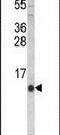 Hepcidin Antimicrobial Peptide antibody, PA5-26470, Invitrogen Antibodies, Western Blot image 