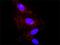 Alpha-2-Macroglobulin antibody, H00000002-M03, Novus Biologicals, Proximity Ligation Assay image 