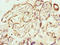 Protein Phosphatase With EF-Hand Domain 1 antibody, LS-C376374, Lifespan Biosciences, Immunohistochemistry paraffin image 