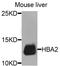 Hemoglobin Subunit Alpha 2 antibody, orb374118, Biorbyt, Western Blot image 