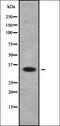 Olfactory Receptor Family 2 Subfamily H Member 1 antibody, orb335657, Biorbyt, Western Blot image 