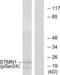 Stathmin 1 antibody, LS-C117489, Lifespan Biosciences, Western Blot image 