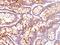 Carcinoembryonic Antigen Related Cell Adhesion Molecule 5 antibody, M00356, Boster Biological Technology, Immunohistochemistry frozen image 