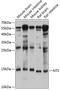 NTS1 antibody, 14-161, ProSci, Western Blot image 
