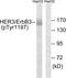 Erb-B2 Receptor Tyrosine Kinase 3 antibody, LS-C199052, Lifespan Biosciences, Western Blot image 