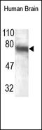 Notch Receptor 2 antibody, 251992, Abbiotec, Western Blot image 