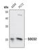 Suppressor Of Cytokine Signaling 2 antibody, PA5-17219, Invitrogen Antibodies, Western Blot image 