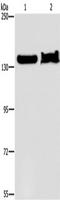 Lysine Demethylase 4A antibody, TA351310, Origene, Western Blot image 