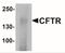 CF Transmembrane Conductance Regulator antibody, NBP2-41265, Novus Biologicals, Western Blot image 
