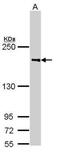 Complement Component 4B (Chido Blood Group), Copy 2 antibody, PA5-29147, Invitrogen Antibodies, Western Blot image 