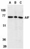 Apoptosis Inducing Factor Mitochondria Associated 1 antibody, GTX21998, GeneTex, Western Blot image 