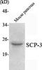 Synaptonemal Complex Protein 3 antibody, M05718, Boster Biological Technology, Western Blot image 