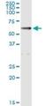 Aldehyde Dehydrogenase 1 Family Member A1 antibody, H00000216-M05, Novus Biologicals, Immunoprecipitation image 