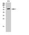 LIM Domain Kinase 1 antibody, STJ93927, St John