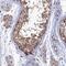 Ribonuclease/Angiogenin Inhibitor 1 antibody, HPA040781, Atlas Antibodies, Immunohistochemistry paraffin image 