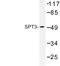 SPT3 Homolog, SAGA And STAGA Complex Component antibody, LS-C176709, Lifespan Biosciences, Western Blot image 