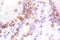 EP300 antibody, LS-C176507, Lifespan Biosciences, Immunohistochemistry paraffin image 