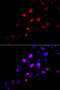 RAD18 E3 Ubiquitin Protein Ligase antibody, 14-988, ProSci, Immunofluorescence image 