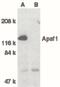 Apoptotic Peptidase Activating Factor 1 antibody, PA5-19894, Invitrogen Antibodies, Western Blot image 