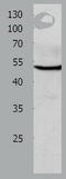 Cholinergic Receptor Nicotinic Alpha 10 Subunit antibody, TA321877, Origene, Western Blot image 