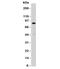 Nucleolin antibody, 34-019, ProSci, Western Blot image 