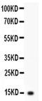 Interleukin 3 antibody, PA5-79498, Invitrogen Antibodies, Western Blot image 