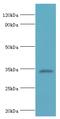 Low Density Lipoprotein Receptor Adaptor Protein 1 antibody, MBS1496150, MyBioSource, Western Blot image 