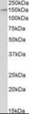 Histone Deacetylase 6 antibody, orb195425, Biorbyt, Western Blot image 