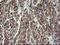 Methionyl-tRNA formyltransferase, mitochondrial antibody, M11112, Boster Biological Technology, Immunohistochemistry paraffin image 