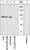 Protein Kinase C Epsilon antibody, GTX25811, GeneTex, Western Blot image 