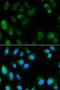 Uncoupling Protein 3 antibody, LS-C331518, Lifespan Biosciences, Immunofluorescence image 
