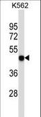 Purinergic Receptor P2X 5 antibody, LS-C163315, Lifespan Biosciences, Western Blot image 