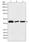 TAR DNA Binding Protein antibody, M01001-2, Boster Biological Technology, Western Blot image 