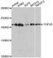DNA Topoisomerase II Alpha antibody, A0726, ABclonal Technology, Western Blot image 