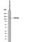 UNC5H2 antibody, PA5-47038, Invitrogen Antibodies, Western Blot image 