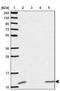 Diazepam Binding Inhibitor, Acyl-CoA Binding Protein antibody, NBP2-38648, Novus Biologicals, Western Blot image 