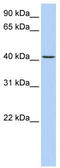 Transmembrane Protein 144 antibody, TA342369, Origene, Western Blot image 