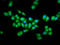 Elongator Acetyltransferase Complex Subunit 2 antibody, LS-C680415, Lifespan Biosciences, Immunofluorescence image 