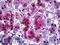 Serpin Family A Member 3 antibody, LS-B5372, Lifespan Biosciences, Immunohistochemistry paraffin image 